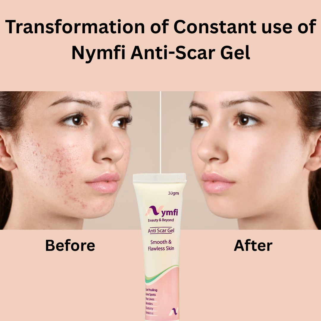 Anti Scar Gel for Advanced Scar & Skin Repair