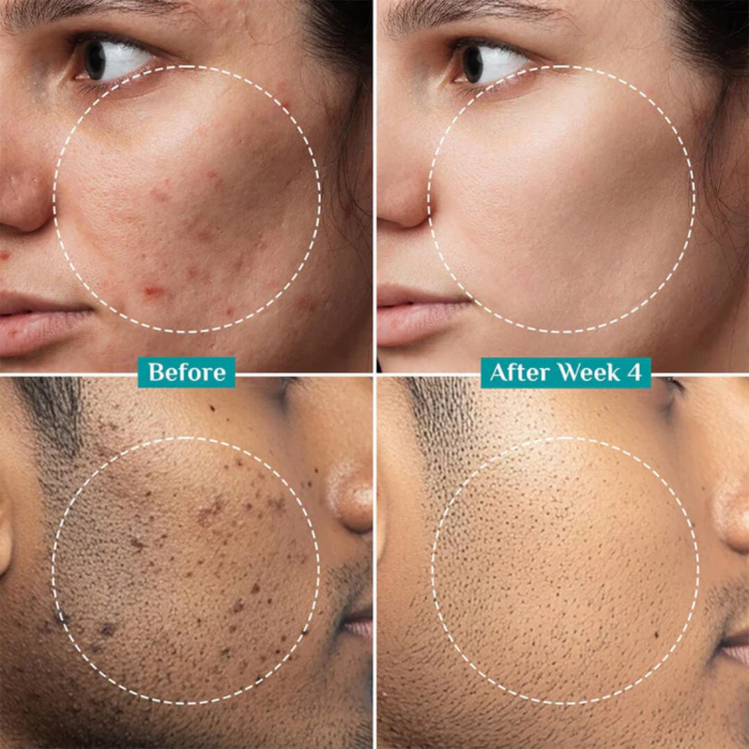 Glow & Hydrate Bundle: Radiance Boost Duo