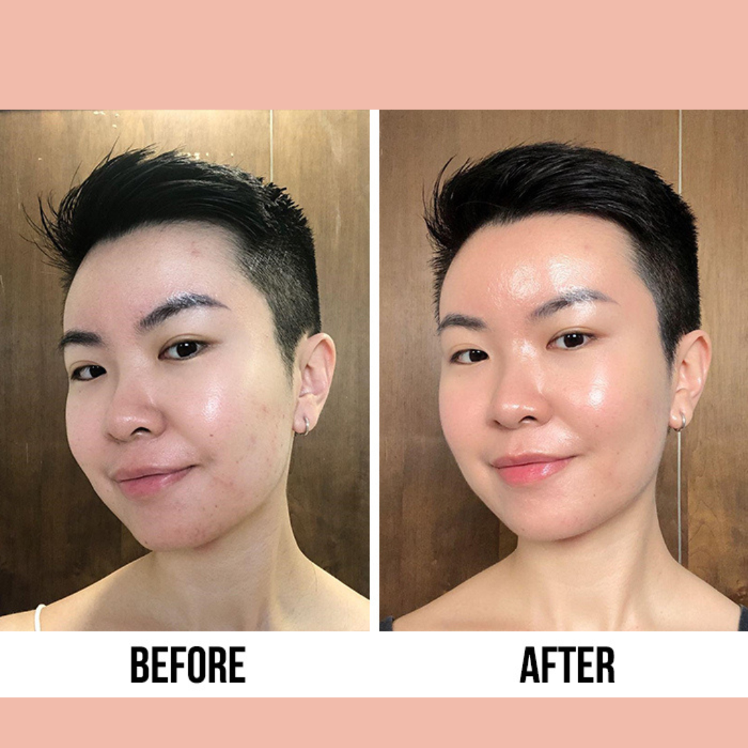 Glow & Hydrate Bundle: Radiance Boost Duo